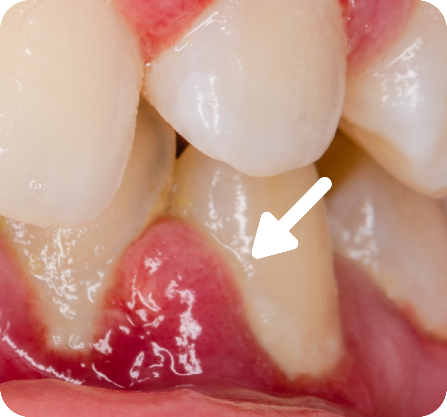 Are your gums swollen?