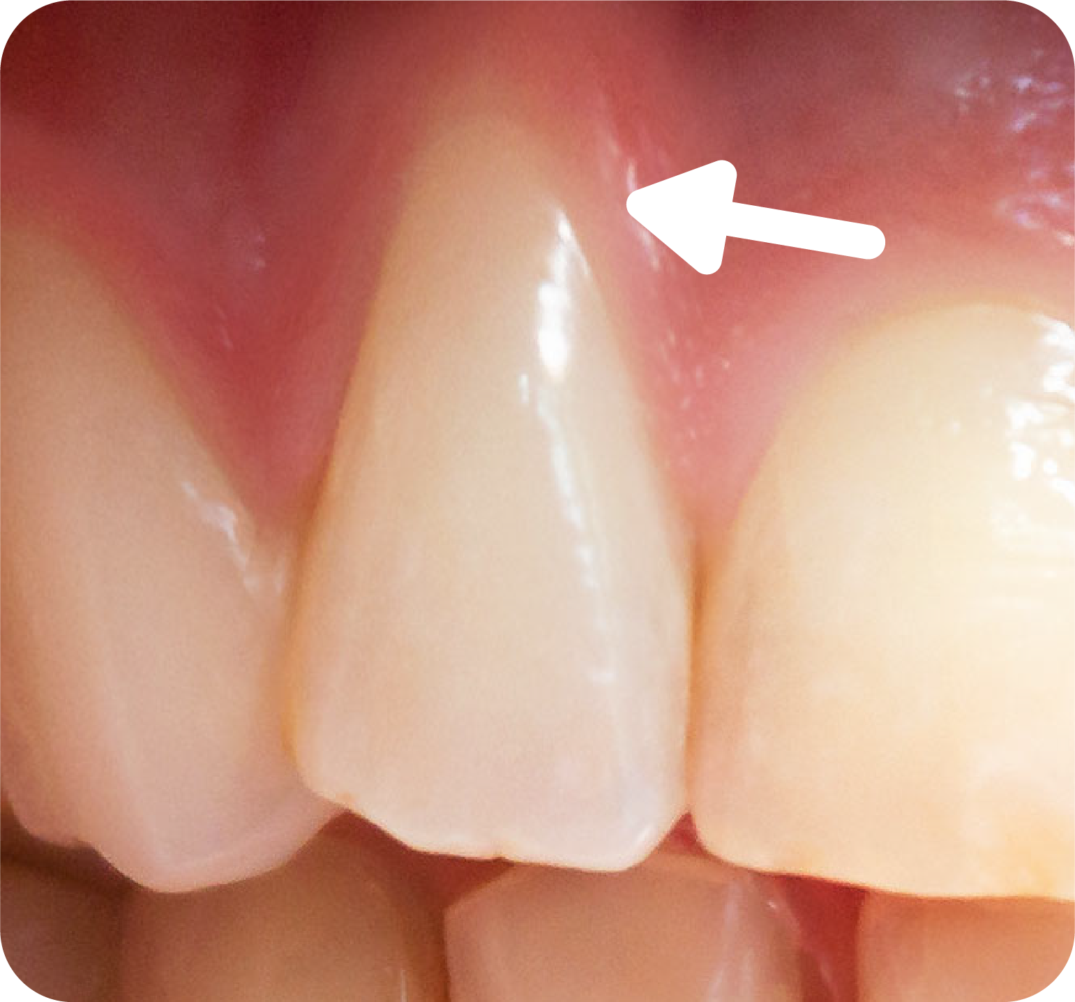 Are your teeth unusually elongated?