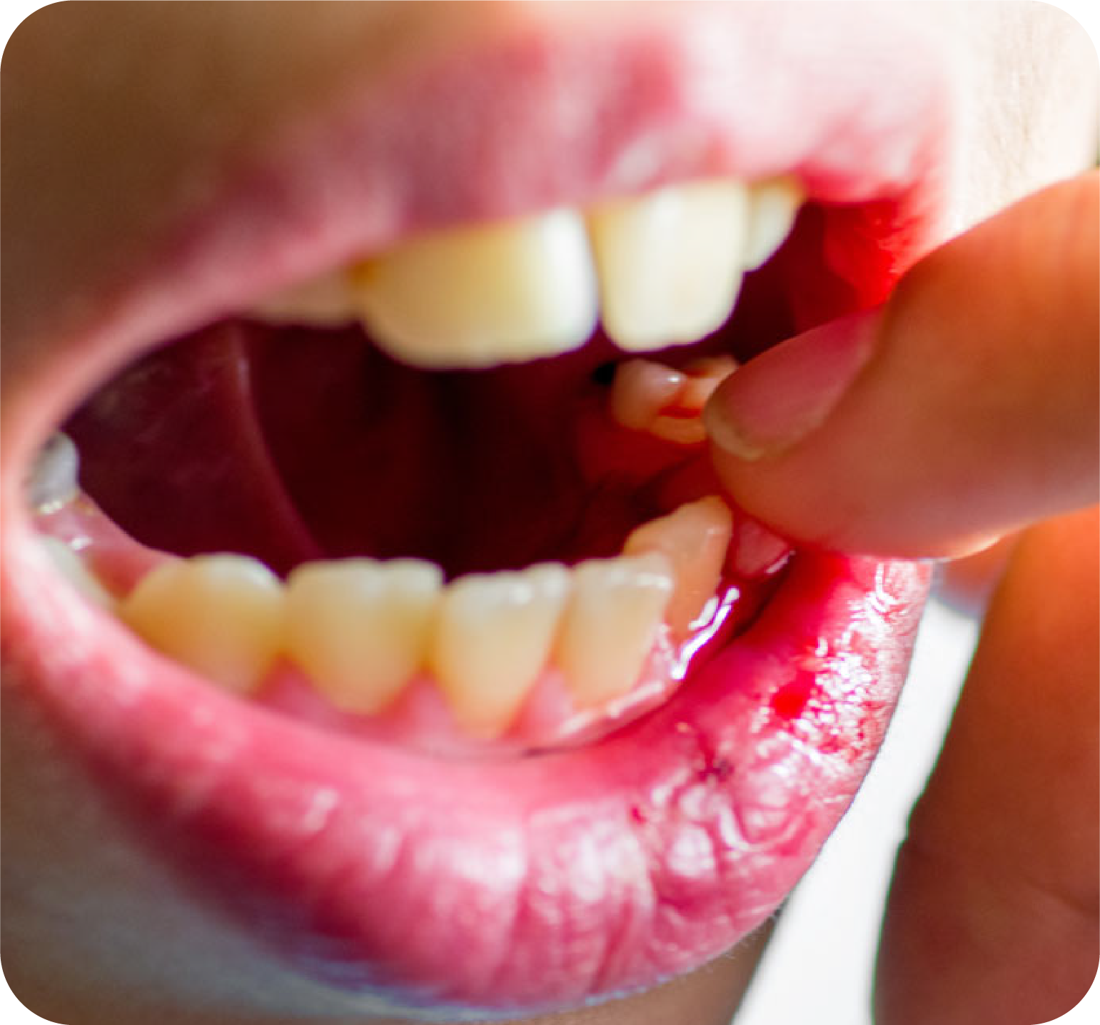 Are your teeth loose?