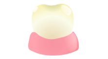 Stained & Yellowish Teeth