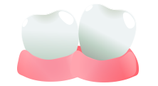 Uneven Teeth